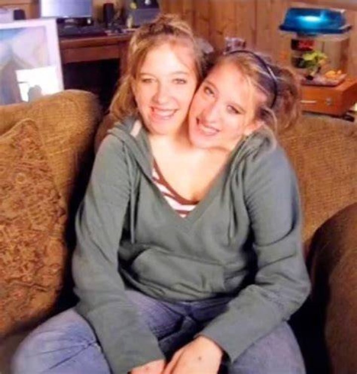 Are Cojoined Twins Abby And Brittany Hensel Married In 2022?