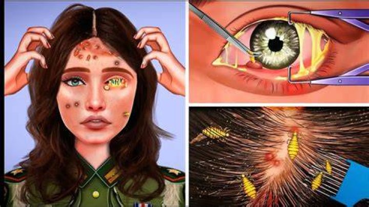 ASMR Dirty Hair Maggot & Worm Removal Deep Cleaning Animation YouTube