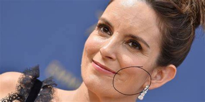 Celebrities with scars Chron