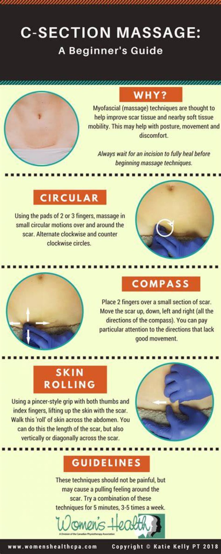 Csection infographics final copy Katie Kelly