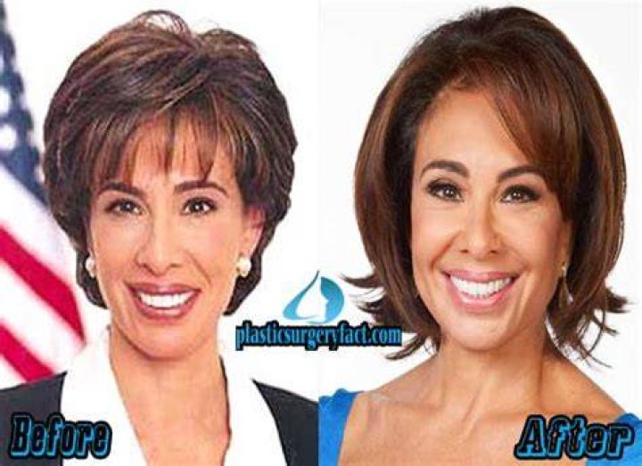 Did Jeanine Pirro Get Plastic Surgery? Body Measurements and More