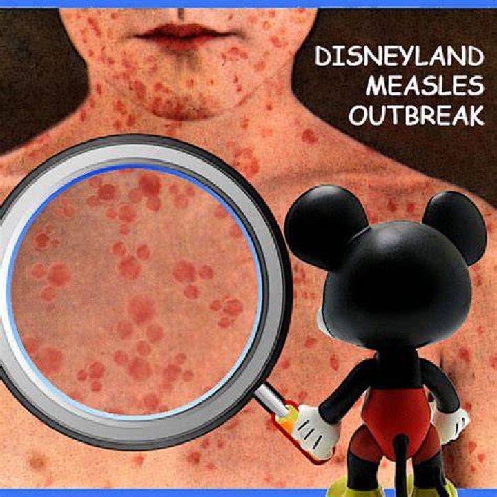 Disneyland measles outbreak continues to spread