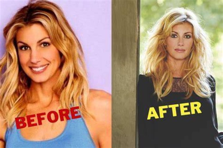 Has Faith Hill Gotten Plastic Surgery in 2017?