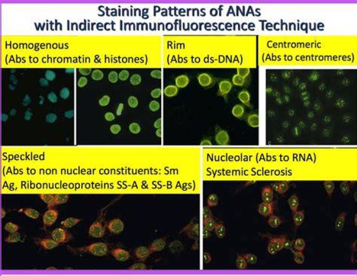 Homogeneous Ana Pattern Pagswa