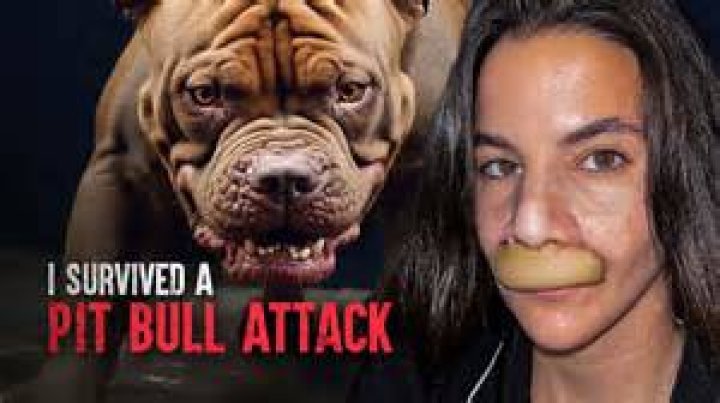 Horror pit bull attack leaves woman with multiple amputated limbs