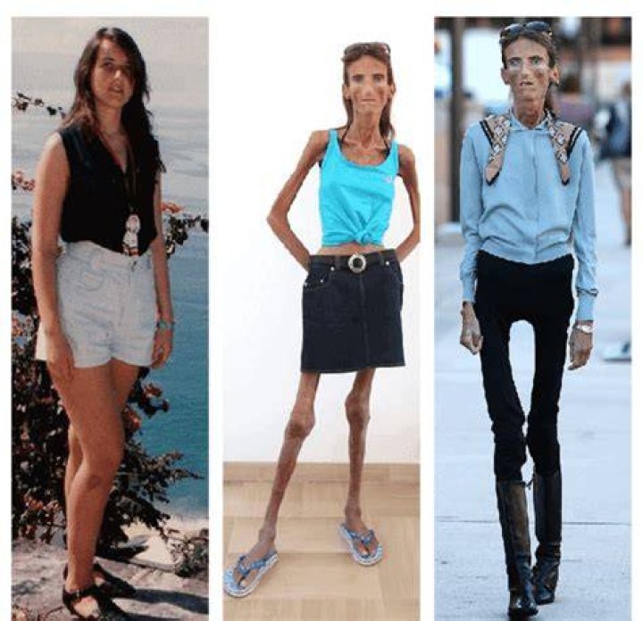 How Much Does The Skinniest Person On Earth Weigh The Earth Images
