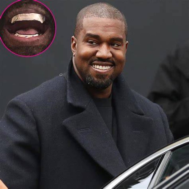 Kanye West gets 850K titanium dentures modeled after James Bond spy