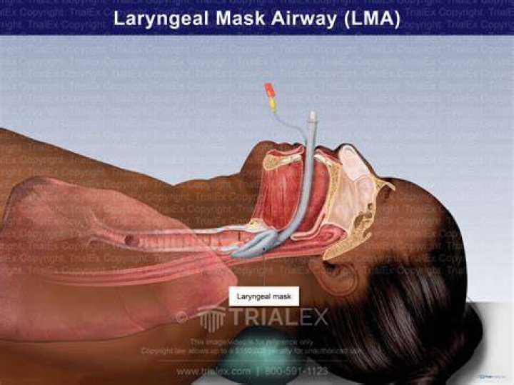 LMA Meaning What Does This Acronym Stand For? Love English