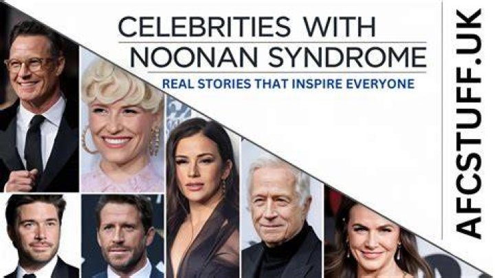 Meet Celebrities with Noonan Syndrome Inspiring Stories yabo亚博