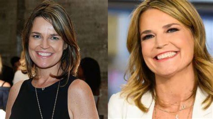 Savannah Guthrie Plastic Surgery What Is the Real Story?