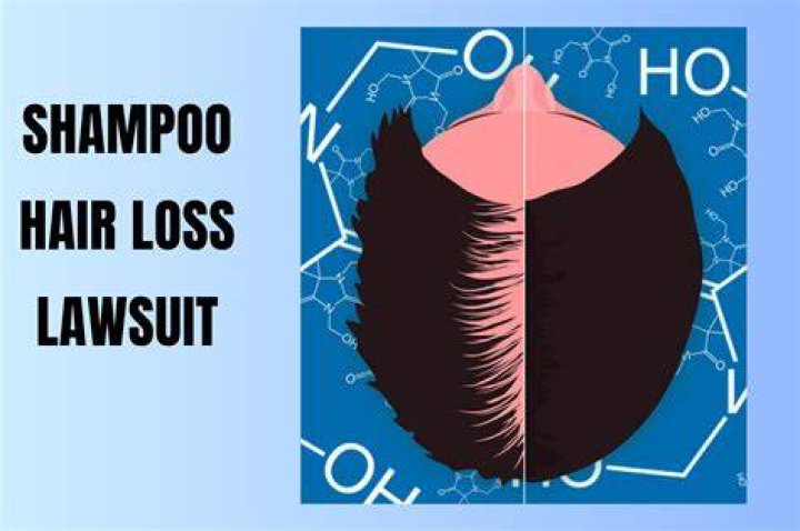 Shampoo Hair Loss Lawsuit Fitness Beauty Art