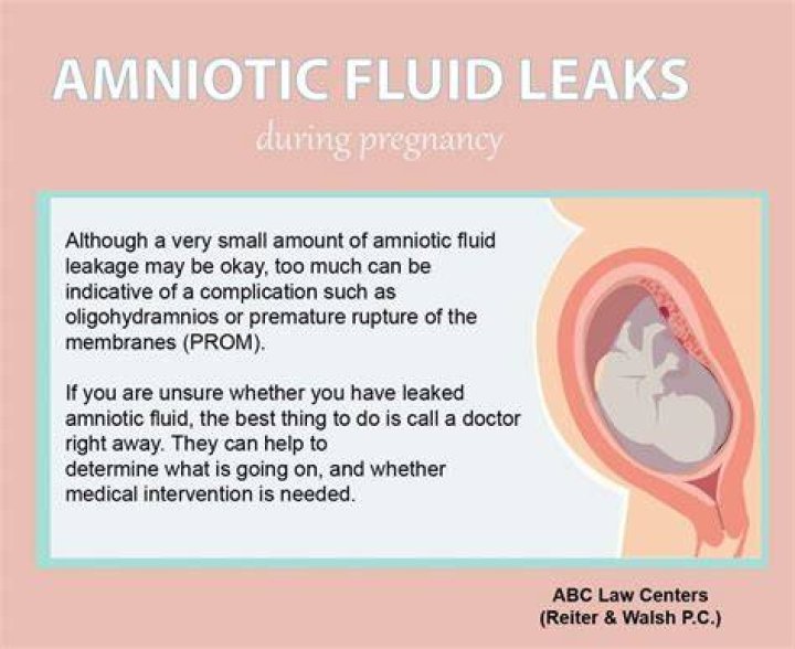 Signs of leaking amniotic fluid dryryte