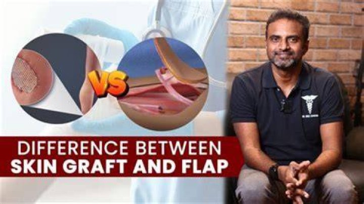 Understanding The Differences: Flank Vs Flap