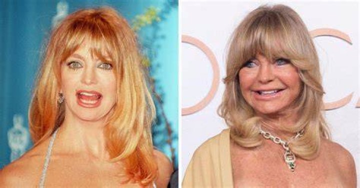 Unveiling The Charm: Goldie Hawn Before Plastic Surgery